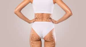 Backside of woman's sculpted body after liposuction