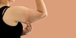 Woman evaluating excess upper arm tissue before arm contouring surgery consultation