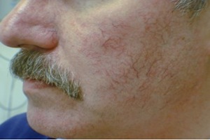 Patient # 68673 Before Photo # 1