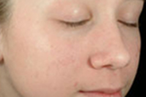 Patient # 69894 After Photo # 2