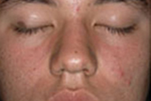 Patient # 85931 After Photo # 2