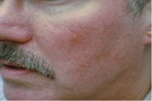 Patient # 68673 After Photo # 2