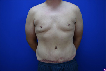 Patient # 42227 After Photo # 2