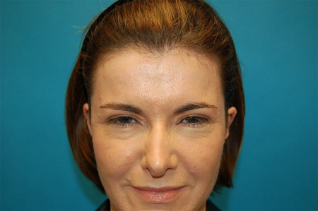 Patient # 49067 After Photo # 2