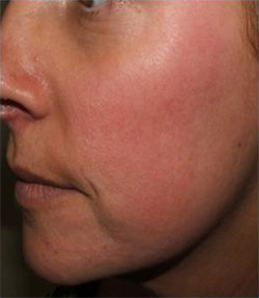 Patient # 76991 After Photo # 2