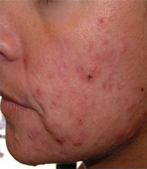 Patient # 76991 Before Photo # 1