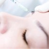 Dermal Fillers