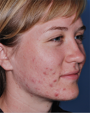 Patient # 37689 Before Photo # 1