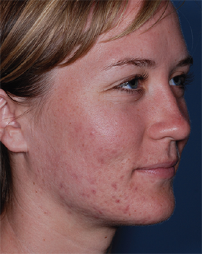 Patient # 37689 After Photo # 2