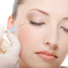 dermal fillers