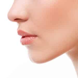 juvederm voluma grand rapids mi juvederm voluma grand rapids mi