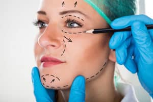 Facelift Grandville MI