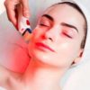 Microneedling