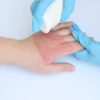 Doctor's hands holding a female patient burn hands