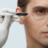 young man with lines getting plastic operation on eyelids