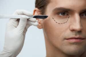 young man with lines getting plastic operation on eyelids