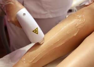 Laser Treatment Wyoming MI