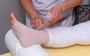 Doctor wrapping patient's leg after successful skin grafting procedure