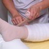 Doctor wrapping patient's leg after successful skin grafting procedure