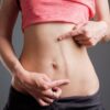 Close-up of a woman pointing to a vertical scar on her abdomen, illustrating a common area treated with scar revision surgery